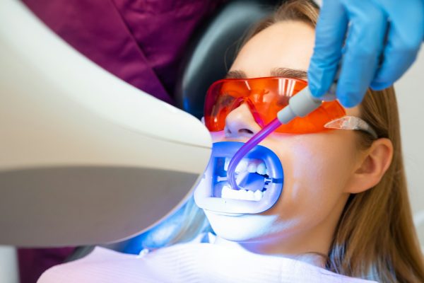 Suction of saliva from the oral cavity during the teeth whitening procedure